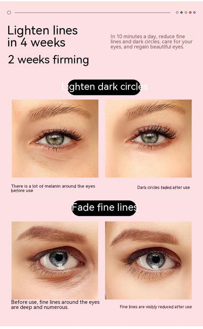 Intelligent Microcurrent Eye Massager – Dark Circle & Puffiness Remover